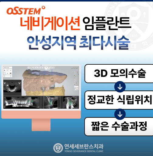 안성시 임플란트 치과