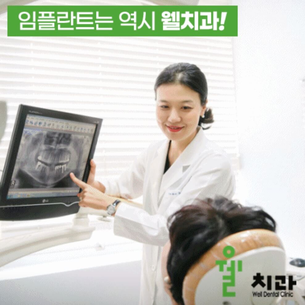 고양시 일산동구 임플란트 일산웰치과