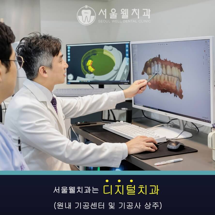 남양주시 임플란트 서울웰치과