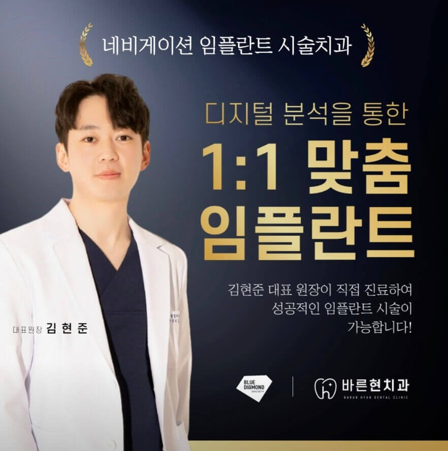 옥천군 임플란트 바른현치과