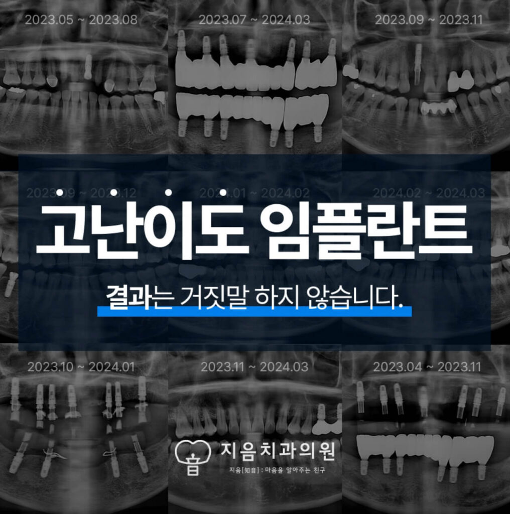 광운대역 임플란트 지음치과
